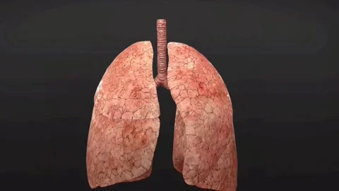 Mild asthmatic lungs Stock Footage 294376484