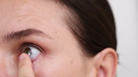 Millennial woman put or remove contact lens Stock Footage 247173491