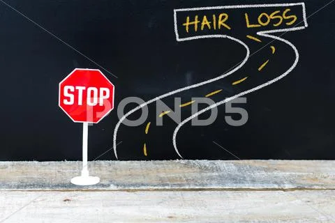 Mini STOP sign on the road to HAIR LOSS Stock Photos
