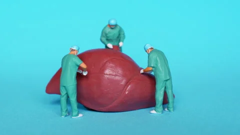 Miniature Surgeons Operating on a Model of Human Liver Stock Footage 285939451