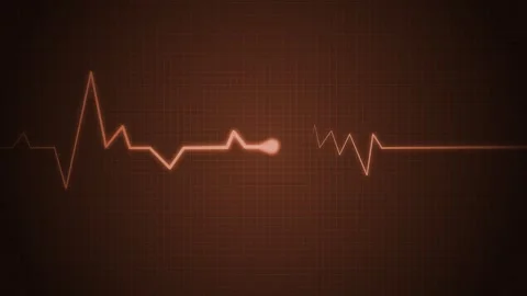 Minimal EKG Line Pulse Animation, Animated Heart Monitor Signal Line Video stock 309965538