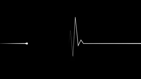 Minimal heartbeat line and sharp pulse spike wave animation Stock Footage 340386498