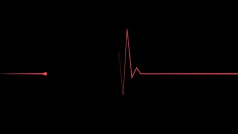Minimal heartbeat line and sharp pulse spike wave animation Stock Footage 340386548