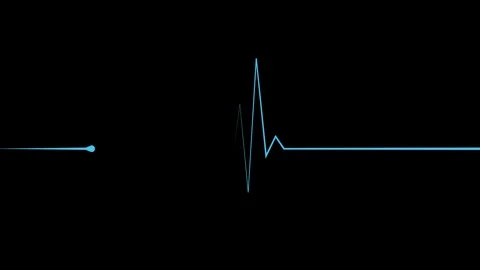 Minimal heartbeat line and sharp pulse spike wave animation Видео 340386561