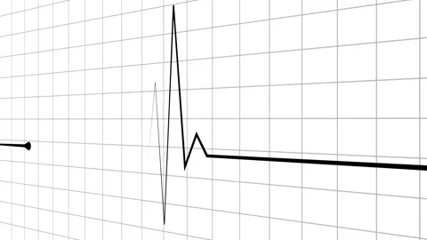Minimal heartbeat line and sharp pulse spike wave animation Stock Footage 340386624