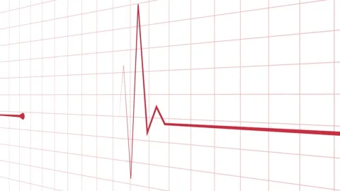 Minimal heartbeat line and sharp pulse spike wave animation Stock Footage 340386648