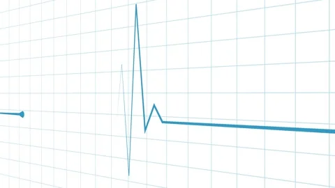 Minimal heartbeat line and sharp pulse spike wave animation Stock Footage 340386659