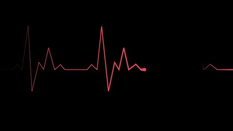 Minimal heartbeat line electrocardiogram style pulse and graph trace animatio Stock Footage 340386077