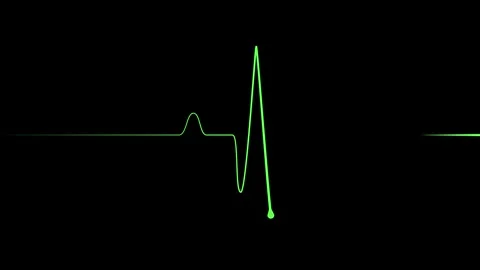 Minimal heartbeat line sharp pulse showing a flat medical monitor trace ani.. Stock Footage 340385784