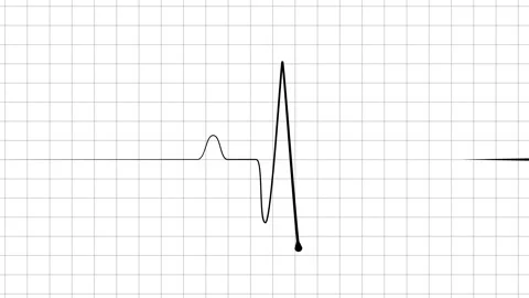 Minimal heartbeat line sharp pulse showing a flat medical monitor trace ani.. Stock Footage 340385791
