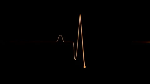 Minimal heartbeat line sharp pulse showing a flat medical monitor trace ani.. Stock Footage 340385792