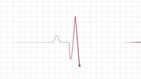 Minimal heartbeat line sharp pulse showing a flat medical monitor trace ani.. Stock Footage 340385797