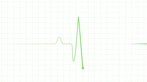 Minimal heartbeat line sharp pulse showing a flat medical monitor trace ani.. Stock Footage 340385804