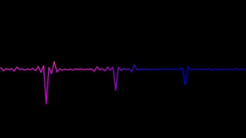 Minimalist Neon Waveform Audio Equalizer Video stock 246616986