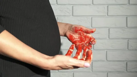 Miscarriage trouble. Stock Footage 275992899