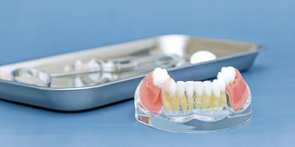 Missing teeth replacement concept. Removable dental prosthesis on light blue  Stock Photos