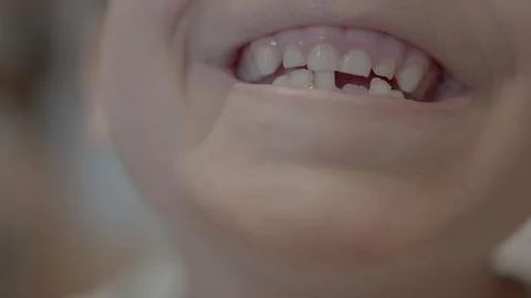 Missing tooth. Close up on a smiling kid showing milk tooth missing and growing Stock Photos
