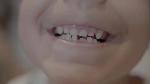 Missing tooth. Close up on a smiling kid showing milk tooth missing and growing Stock Photos