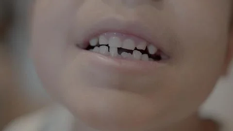Missing tooth. Close up on a smiling kid showing milk tooth missing and growing Stock Photos