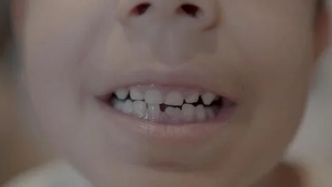 Missing tooth. Close up on a smiling kid showing milk tooth missing and growing Stock Photos