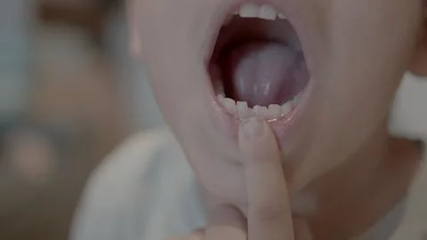 Missing tooth. Close up on a smiling kid showing milk tooth missing and growing Stock Photos