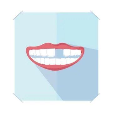 Missing Tooth 스톡 일러스트