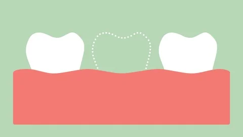 Missing tooth, space in mouth Stock Footage 93328744