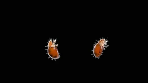 Mite (acari) Oribatida under a microscope, Suborder Mixonomata. Stock Footage 157821706