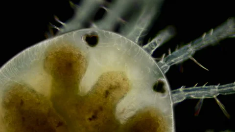 Mite Hydrachnidia under the microscope Stock Footage 109285748