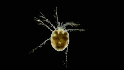 Mite Hydrachnidia under the microscope Stock Footage 109335226