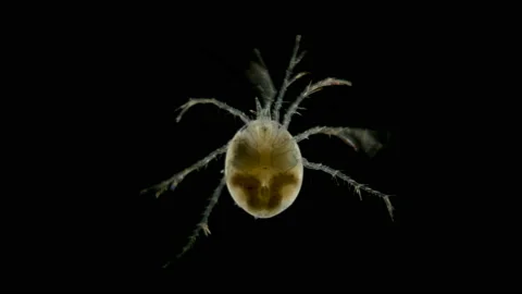 Mite Hydrachnidia under the microscope Stock Footage 109335732