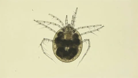 Mite Hydrachnidia under the microscope Stock Footage 109548531