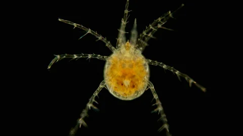 Mite Hydrachnidia under the microscope Stock Footage 109610635