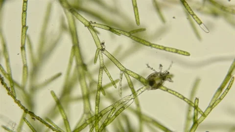 Mite Hydrachnidia under the microscope, live only in water Stock Footage 112453175