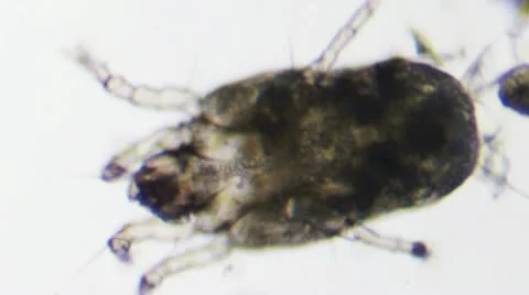 Mite Looking through Microscope Stock Footage 12678032