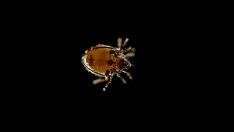 Mite Oribatida under microscope, order Sarcoptiformes Stock Footage 116606004