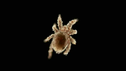 Mite Oribatida under microscope, order Sarcoptiformes, Arachnida class Stock Footage 128397551