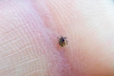 Mite on a skin Foto stock