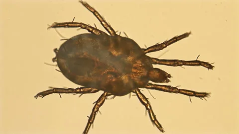 Mite under the microscope, detachment Sarcoptiformes Stock Footage 112547418