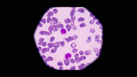 Mixed cells in stop motion footage. Stock Footage 200408244