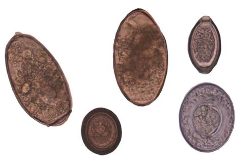Mixed egg of parasite on white. Photos