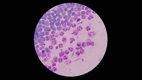Mixed white blood cell in stop motion. 스톡 동영상 200442822