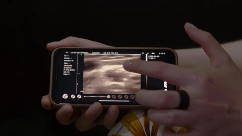 Mobile ultrasound diagnostics using smartphone in healthcare Vídeo Stock 328527982