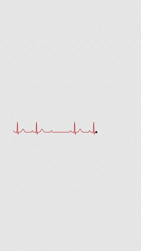 Mobitz II AV Block ECG Heart Rhythm Clean No Text Alpha 4K Vertical 9x16 Light 스톡 동영상 339507182