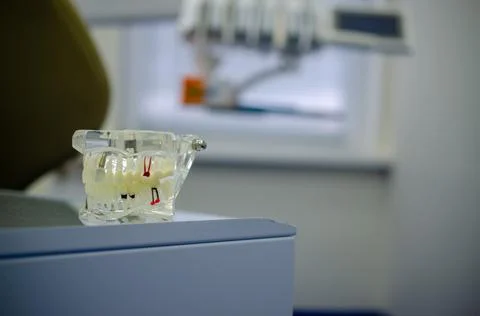 Mock up a sample of the upper and lower jaw in the dentist's office. Stock Photos