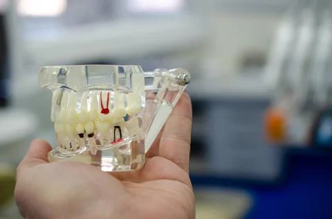 Mock up a sample of the upper and lower jaw in the dentist's office. Stock Photos