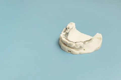 Mockup Metal Frame Lower Partial Denture On Die Stone, Plaster Cast Mold Of Stock Photos