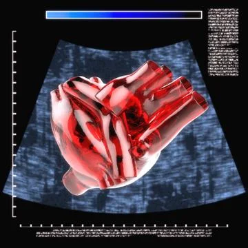 Model of artificial human heart Stock-Illustration