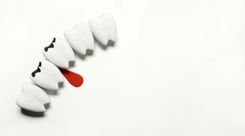 Model Decayed teeth has Bleeding warning for Scurvy Teeth Stock Photos