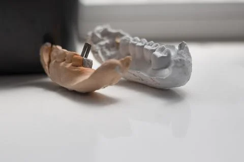 Model of dental prosthesis , close up view Stock Photos